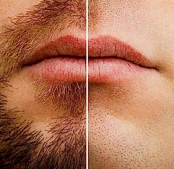 Dejarte crecer mumbai barba